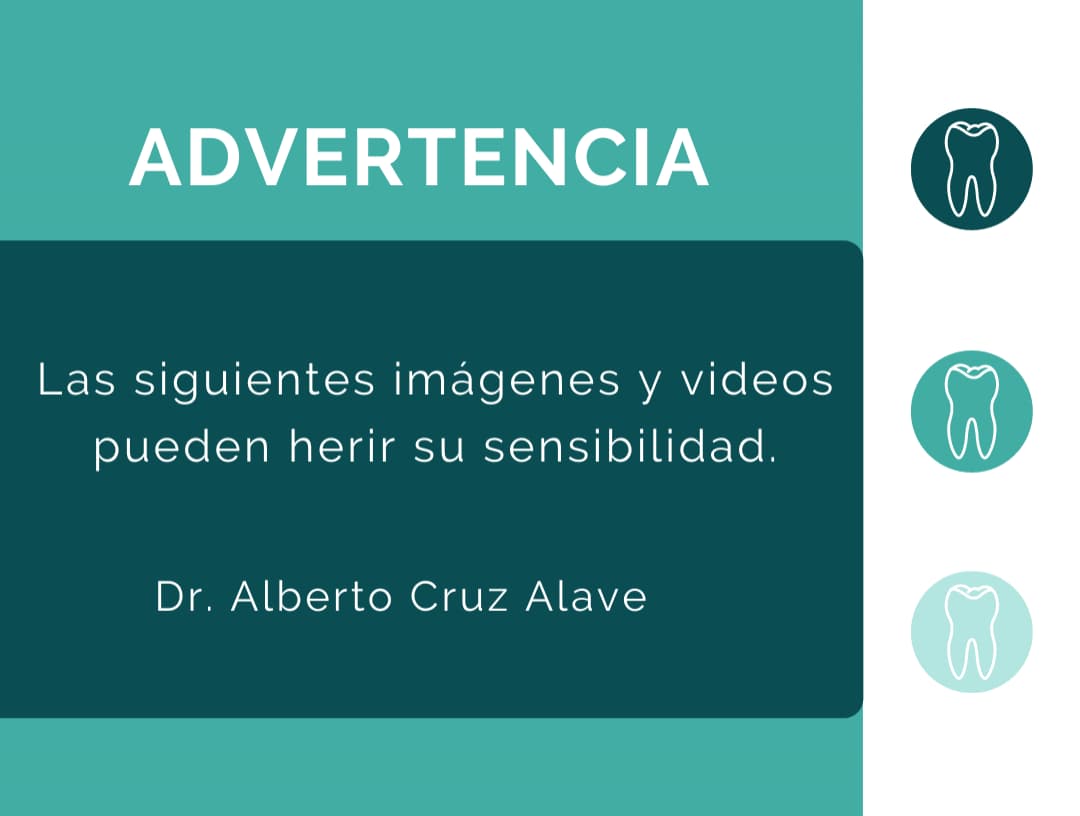 Advertencia: las imágenes que siguen pueden herir la sensibilidad — Dr. Alberto Cruz Alave