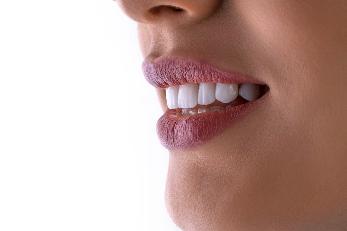 Paciente sonriendo con una sonrisa armónica lograda con estética dental