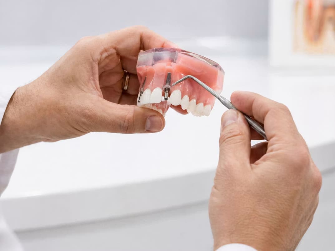 Odontólogo revisando una radiografía panorámica para planificar un implante dental en Ciudad Jardín Lomas del Palomar