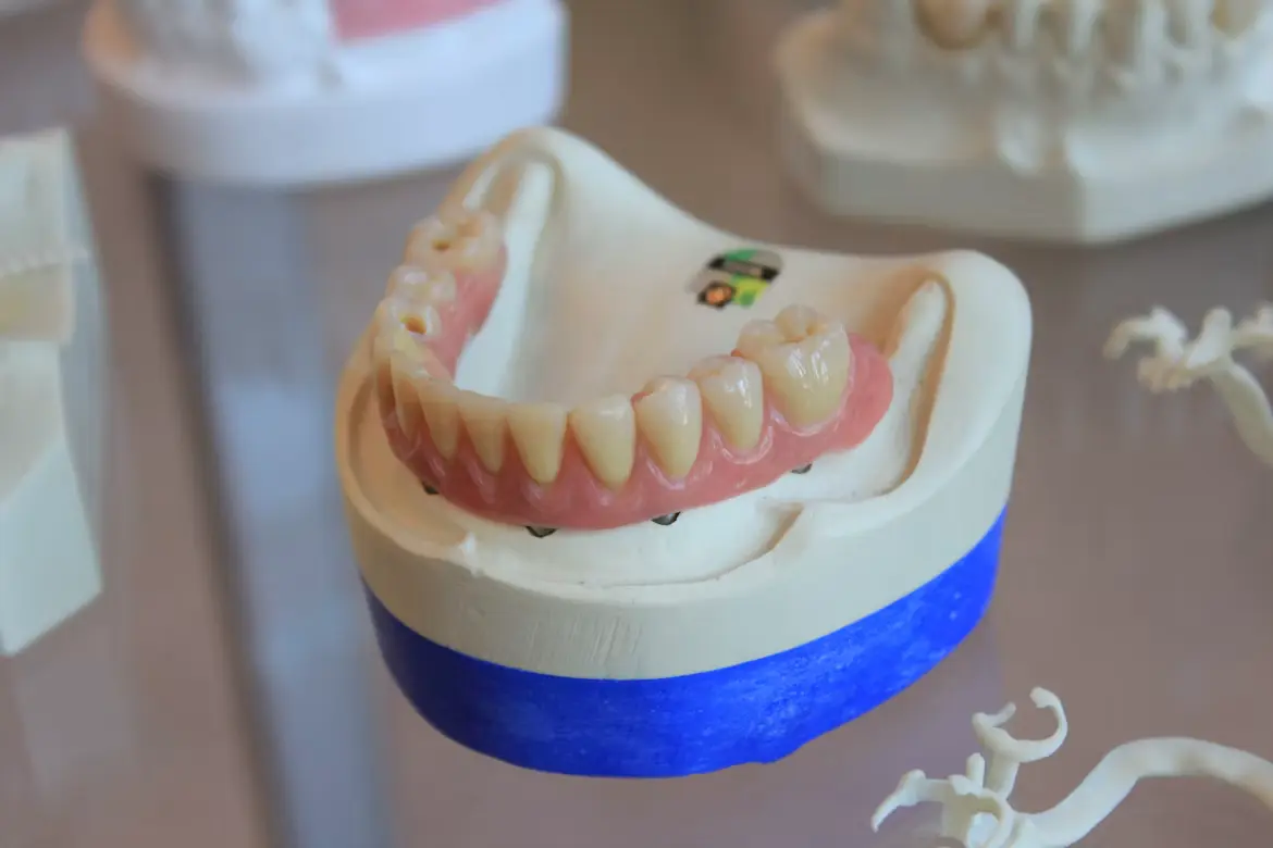 Profesional analizando estudios en 3D para una rehabilitación protésica dental
