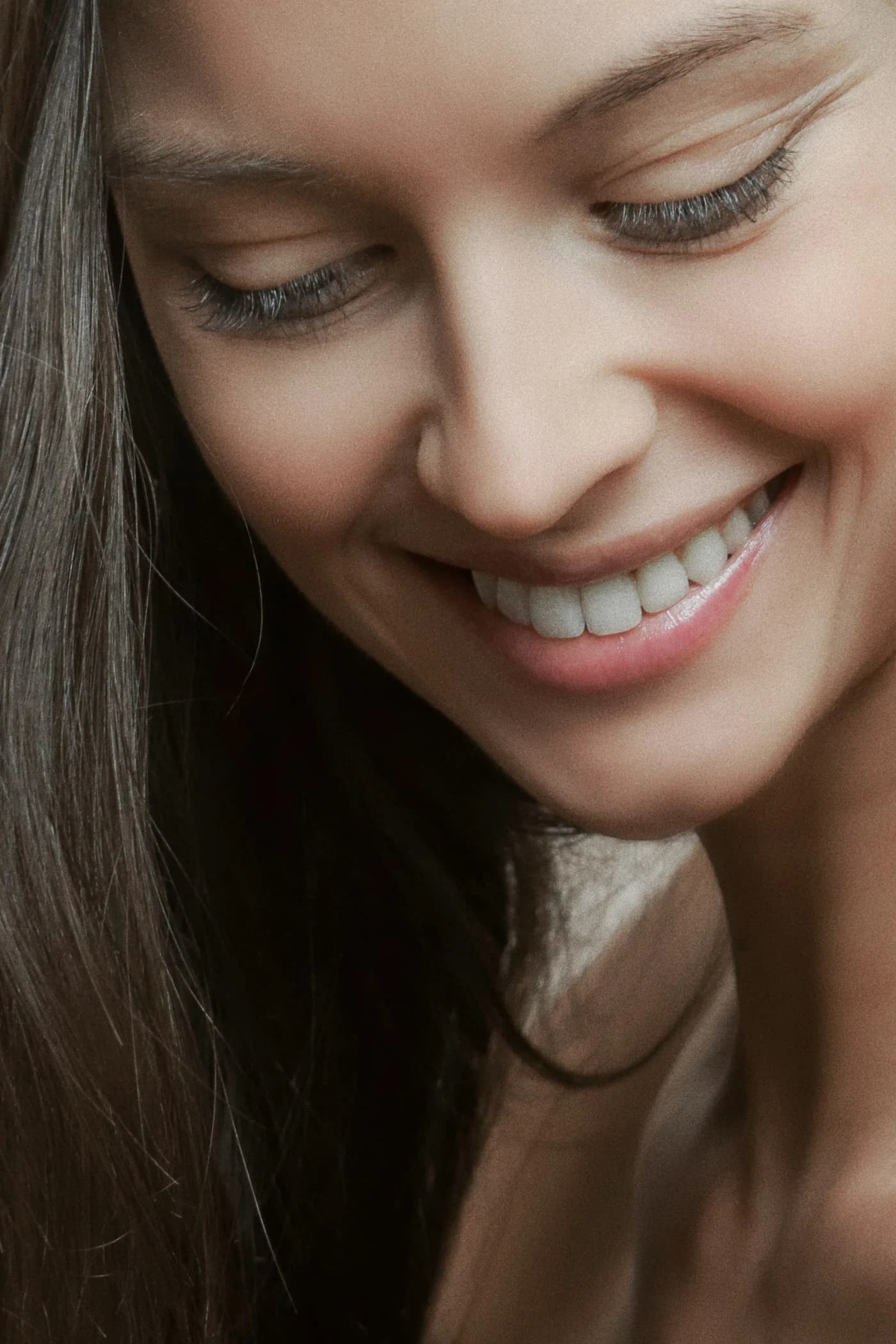 Sonrisa con dientes blancos tras un blanqueamiento dental